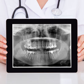 Oral Appliances and Orthotics